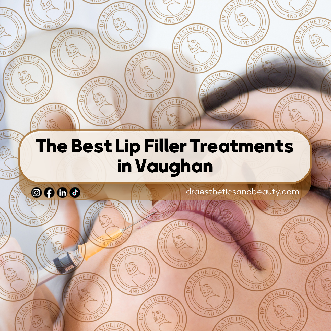The-Best-Lip-Filler-Treatments-in-Vaughan-Natural-Looking-Volume