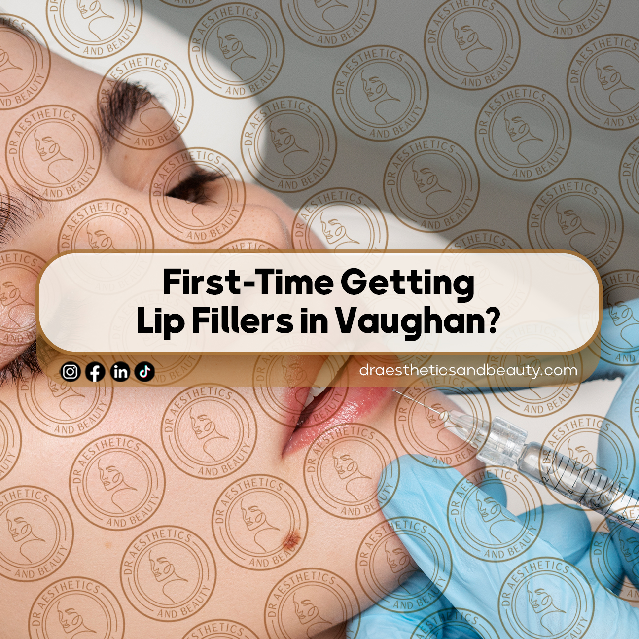 First-Time-Getting-Lip-Fillers-in-Vaughan-Read-This-Guide
