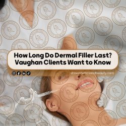 How-Long-Do-Dermal-Filler-Last-Vaughan-Clients-Want-to-Know
