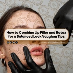 How-to-Combine-Lip-Filler-and-Botox-for-a-Balanced-Look-Vaughan-Tips