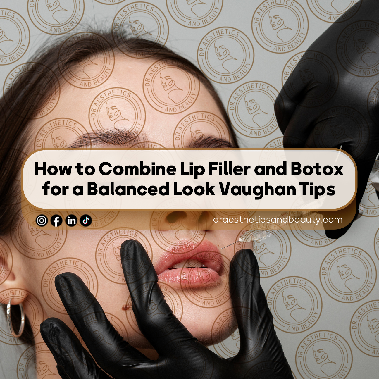 How-to-Combine-Lip-Filler-and-Botox-for-a-Balanced-Look-Vaughan-Tips