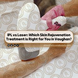 IPL-vs-Laser--Which-Skin-Rejuvenation-Treatment-is-Right-for-You-in-Vaughan-