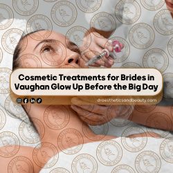 Cosmetic-Treatments-for-Brides-in-Vaughan-Glow-Up-Before-the-Big-Day