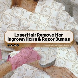 Laser-Hair-Removal-for-Ingrown-Hairs-&-Razor-Bumps