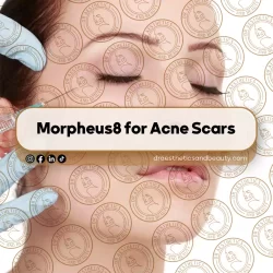 Botox Trends in Vaughan (2026 Data)