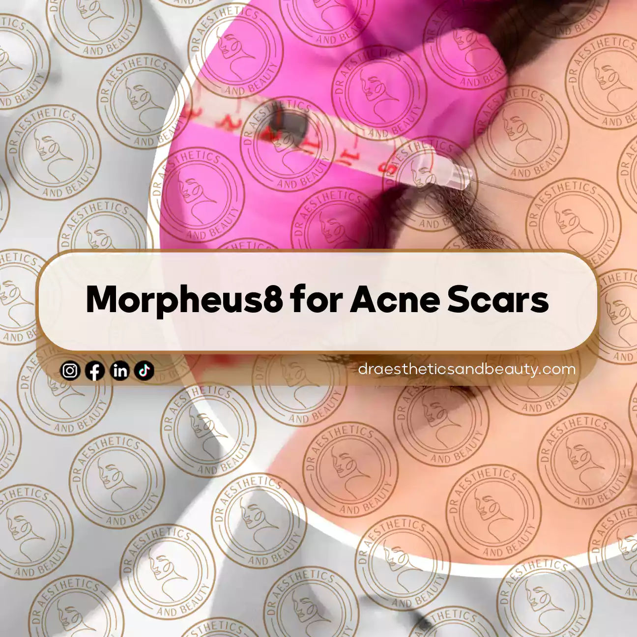 First-Time Botox Guide