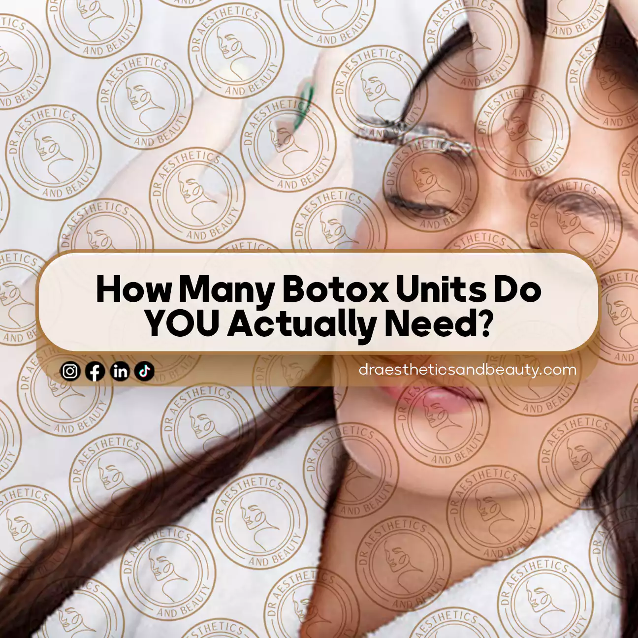 How Many Botox Units Do YOU Actually Need (Real Examples)
