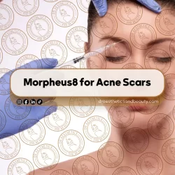 How Many Botox Units Do YOU Actually Need