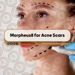 What $500 Gets You in Vaughan Aesthetic Clinics