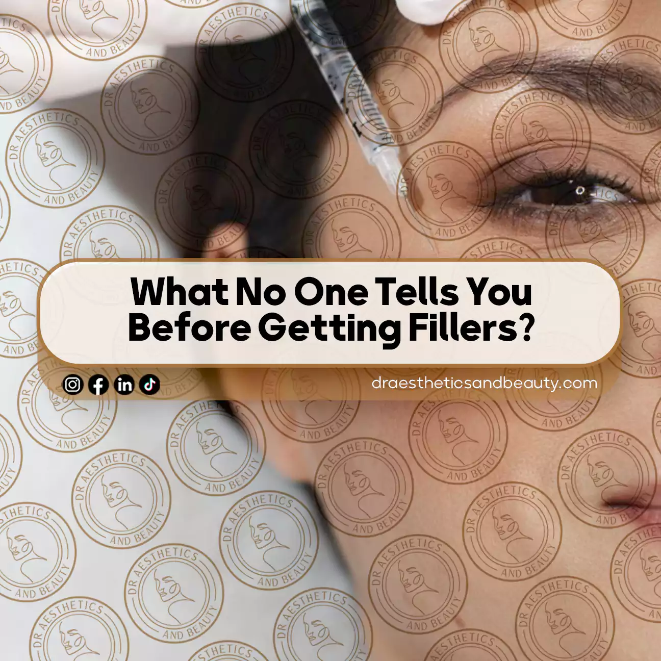 What No One Tells You Before Getting Fillers