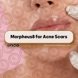 What No One Tells You Before Getting Fillers