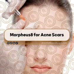 Why Some Botox Fails