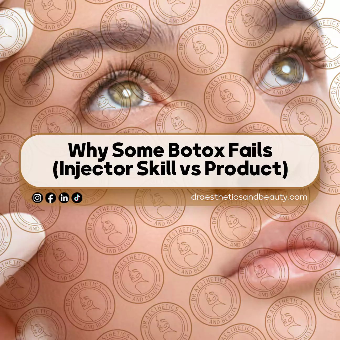 Why Some Botox Fails (Injector Skill vs Product)