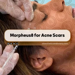 why Botox Results Look Bad