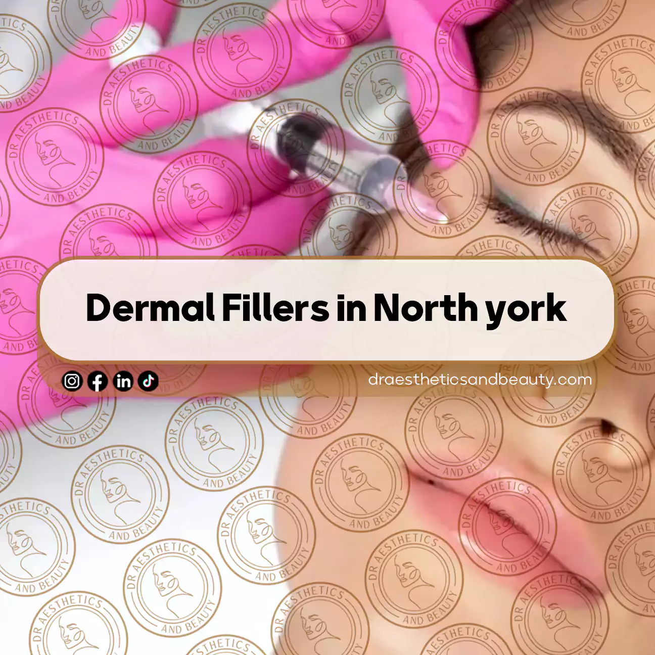 Dermal Fillers in North york