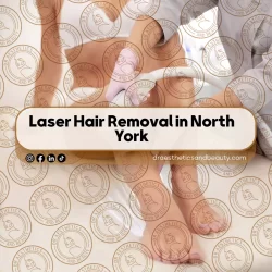 Laser Hair Removal in North York