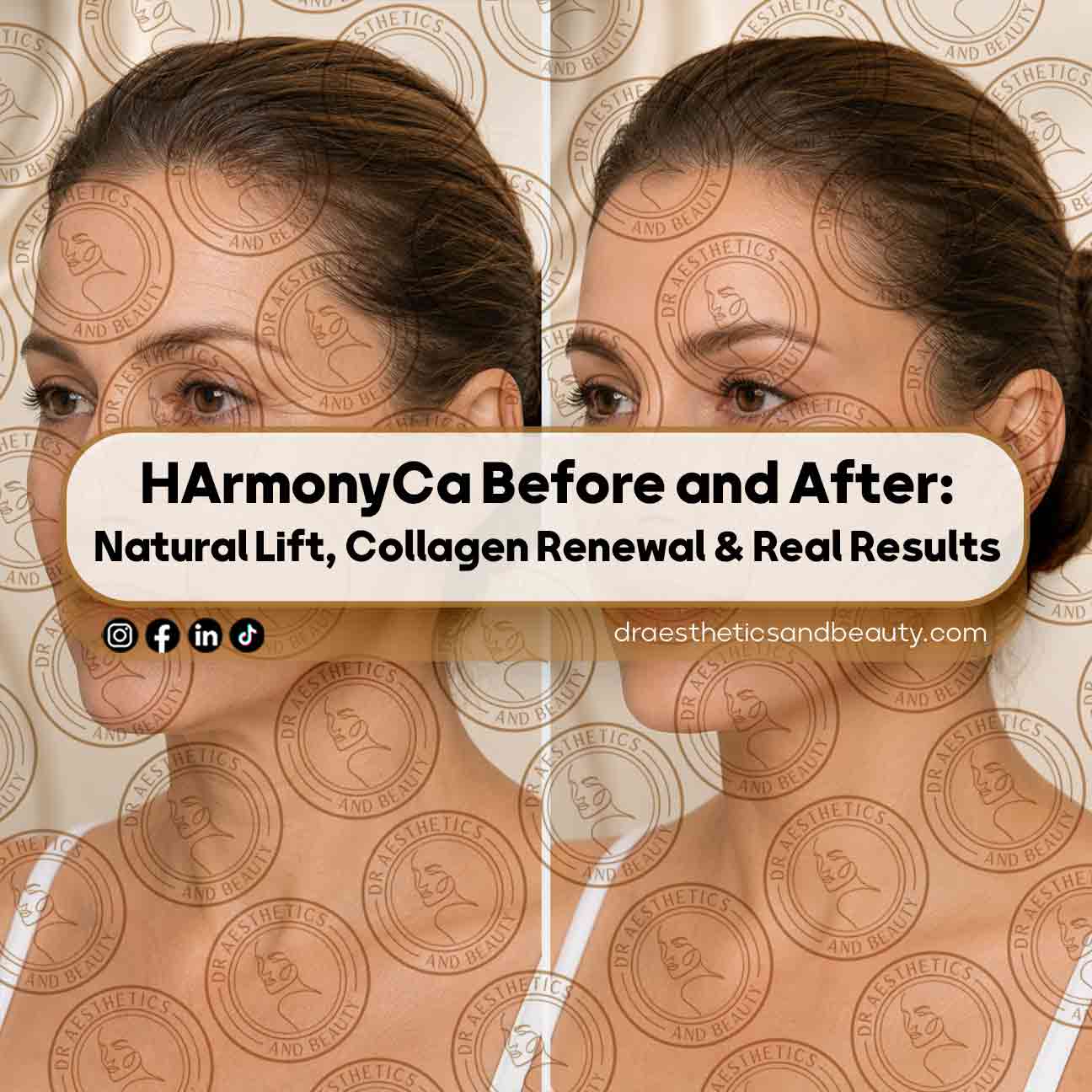 HArmonyCa-Before-and-After-Natural-Lift,-Collagen-Renewal-&-Real-Results