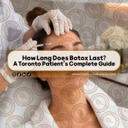 How-Long-Does-Botox-Last--A-Toronto-Patient’s-Complete-Guide