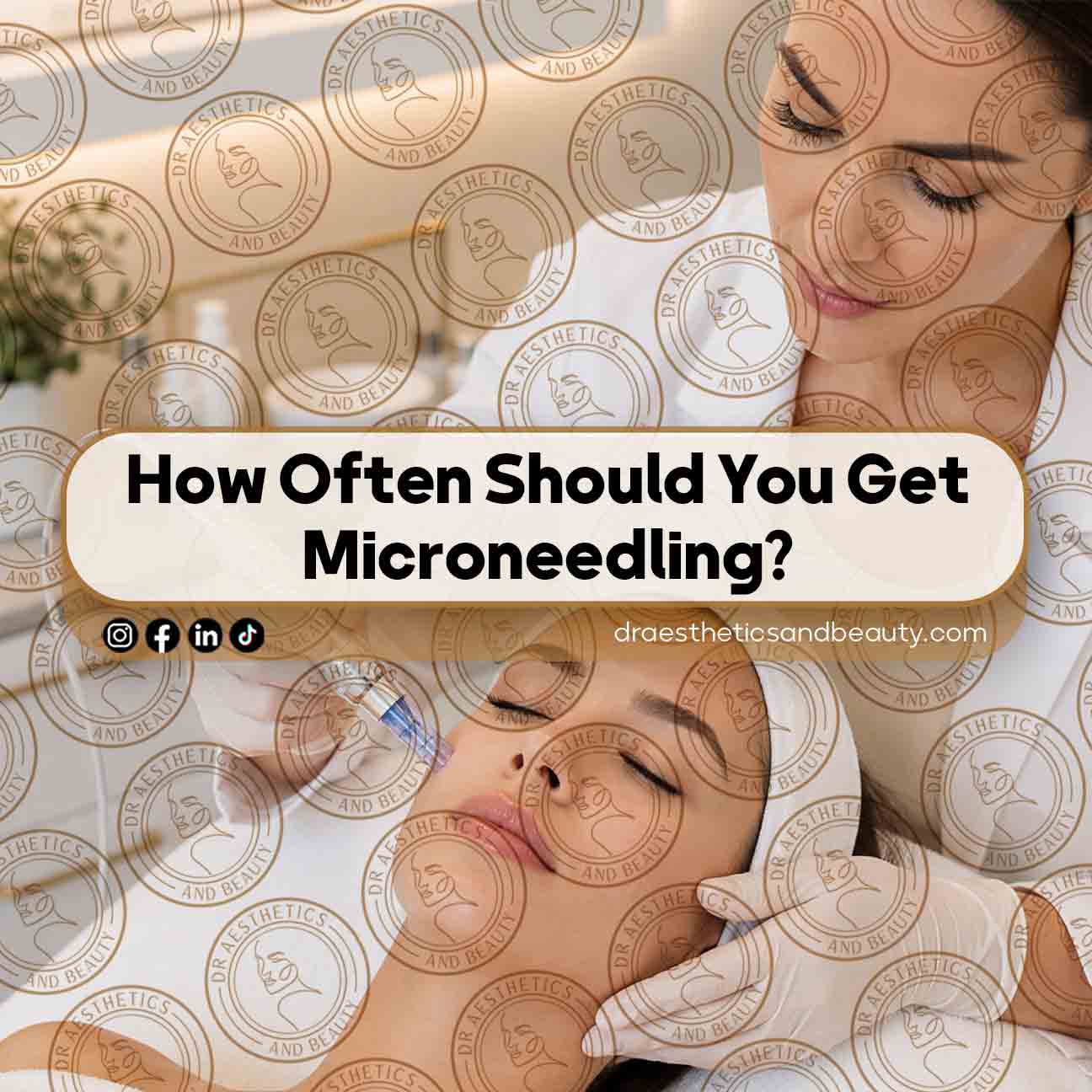 How-Often-Should-You-Get-Microneedling