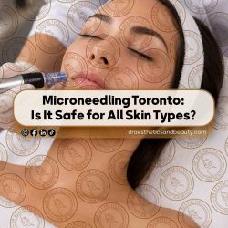 Microneedling-Toronto--Is-It-Safe-for-All-Skin-Types