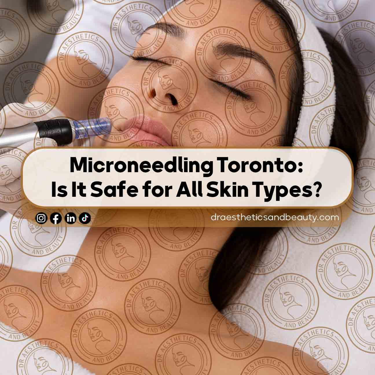 Microneedling-Toronto--Is-It-Safe-for-All-Skin-Types
