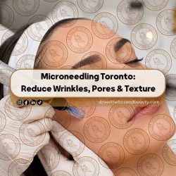 Microneedling-Toronto--Reduce-Wrinkles,-Pores-&-Texture