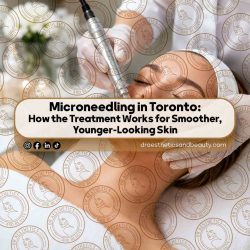 Microneedling-in-Toronto--How-the-Treatment-Works-for-Smoother,-Younger-Looking-Skin