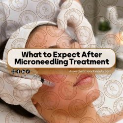 What-to-Expect-After-Microneedling-Treatment-Complete-Guide-for-Toronto-Patients