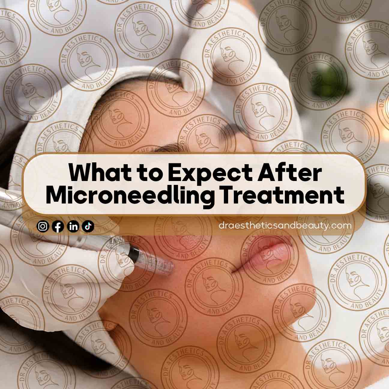 What-to-Expect-After-Microneedling-Treatment-Complete-Guide-for-Toronto-Patients