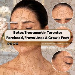 otox-Treatment-in-Toronto--Forehead,-Frown-Lines-&-Crow’s-Feet