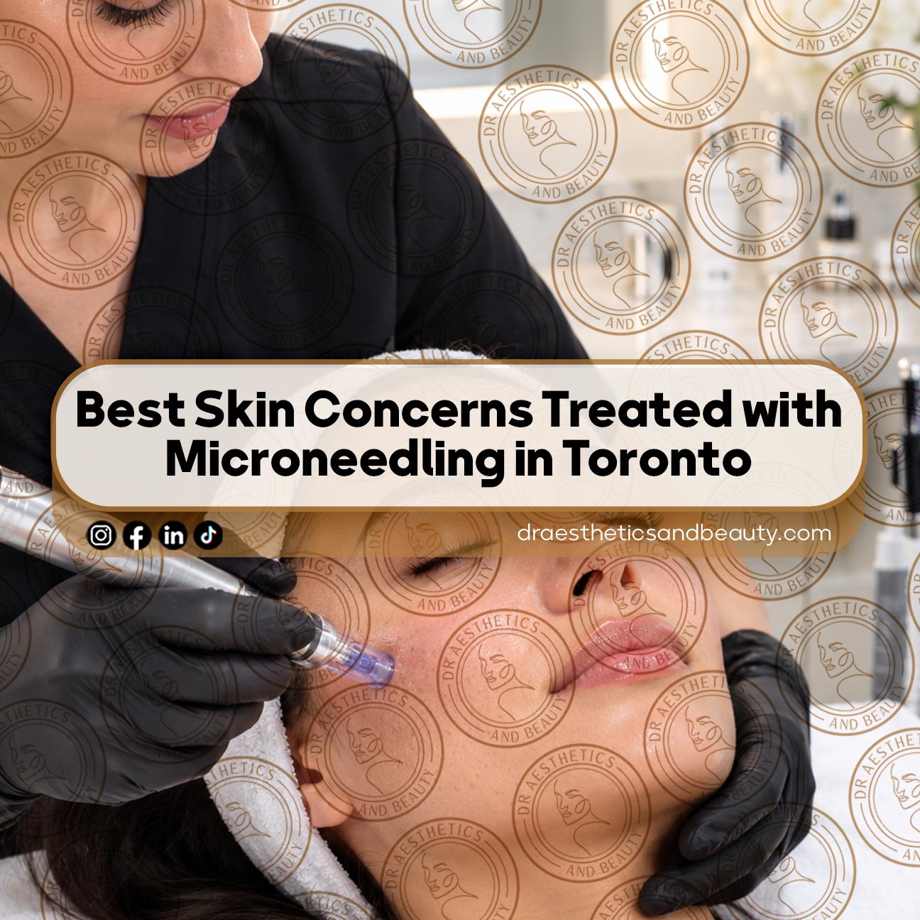 Best-Skin-Concerns-Treated-with-Microneedling-in-Toronto