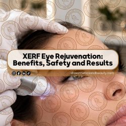 XERF-Eye-Rejuvenation--Benefits,-Safety-and-Results