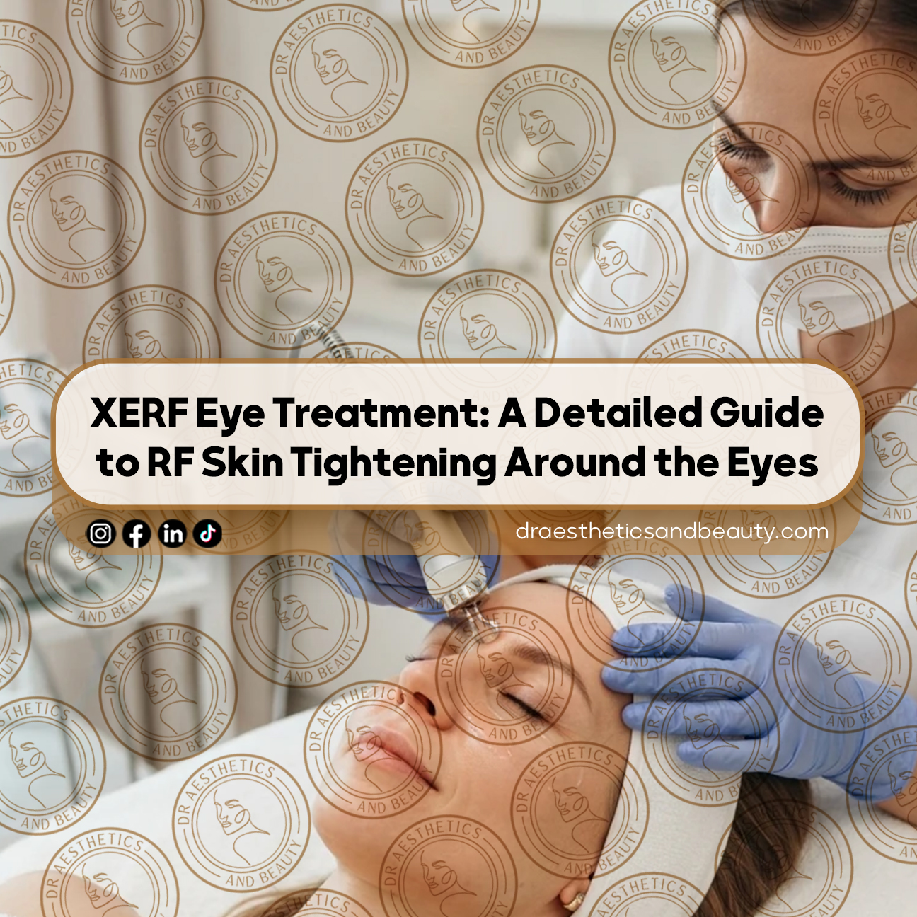 XERF-Eye-Treatment-A-Detailed-Guide-to-RF-Skin-Tightening-Around-the-Eyes