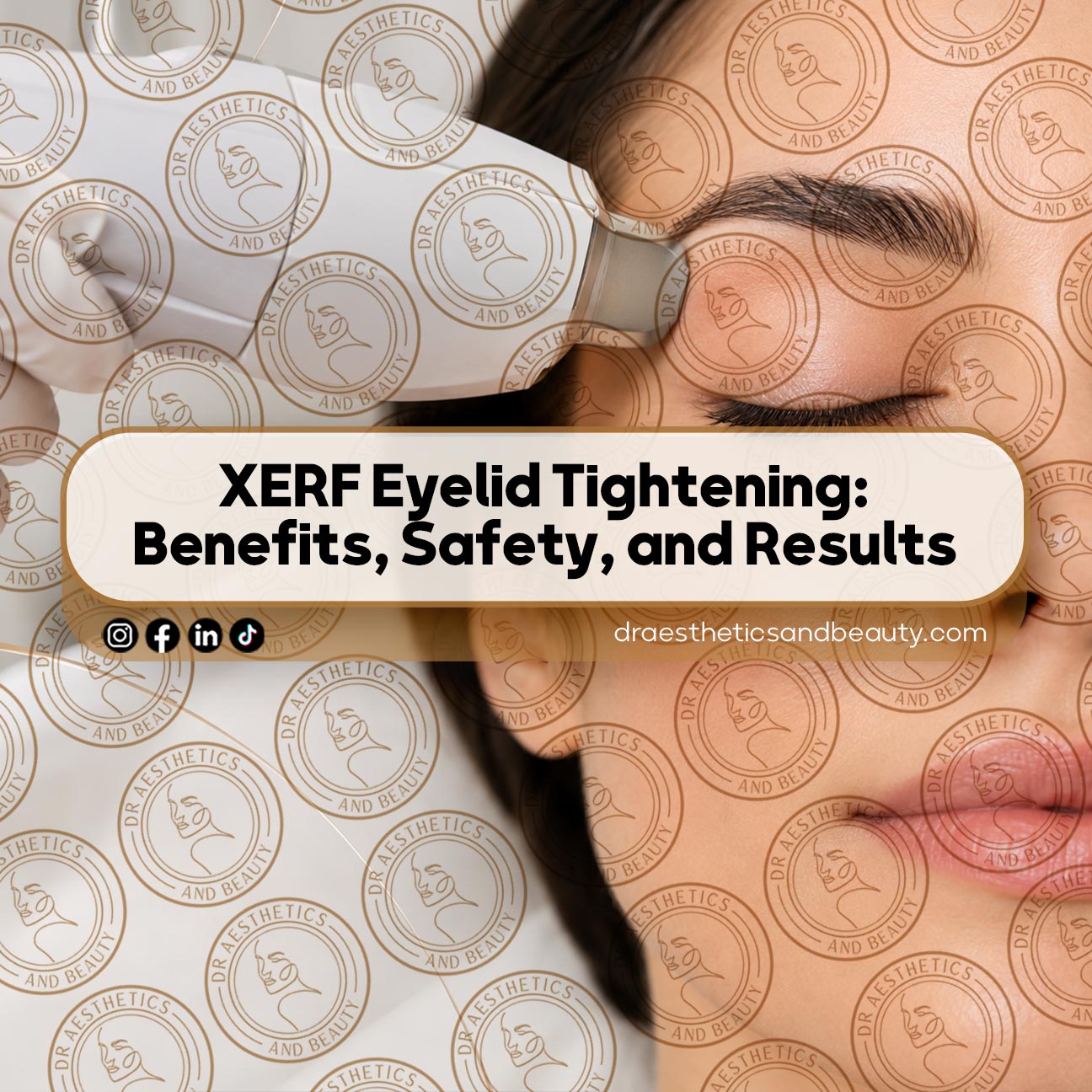 XERF Eyelid Tightening: Benefits, Safety, and Results
