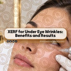 XERF for Under Eye Wrinkles: Benefits and Results
